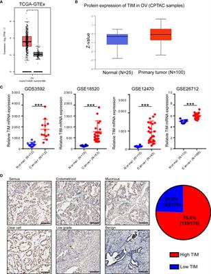 TIMELESS Promotes Tumor Progression by Enhancing Macrophages Recruitment in Ovarian Cancer